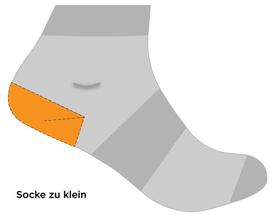 Sitz des Fersendreiecks, wenn eine Socke zu klein ist.